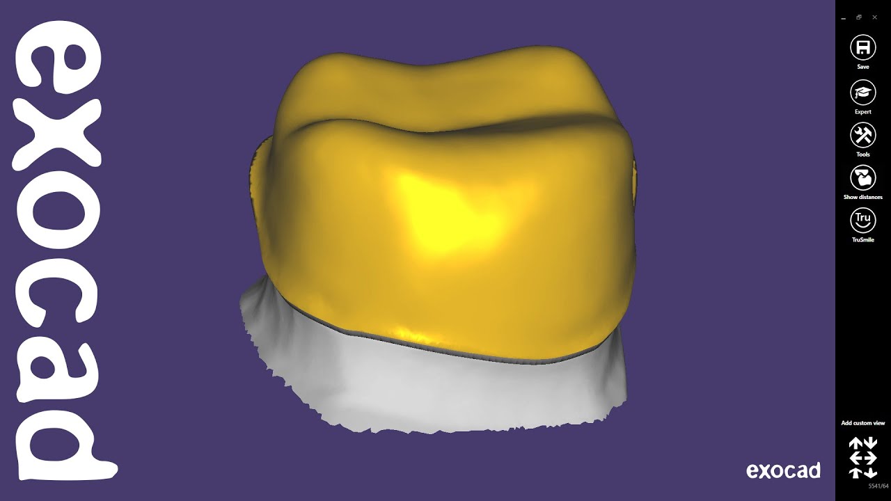 Video Tutorial exocad: Pengantar Fitur Dasar / Desain Mengatasi Offset